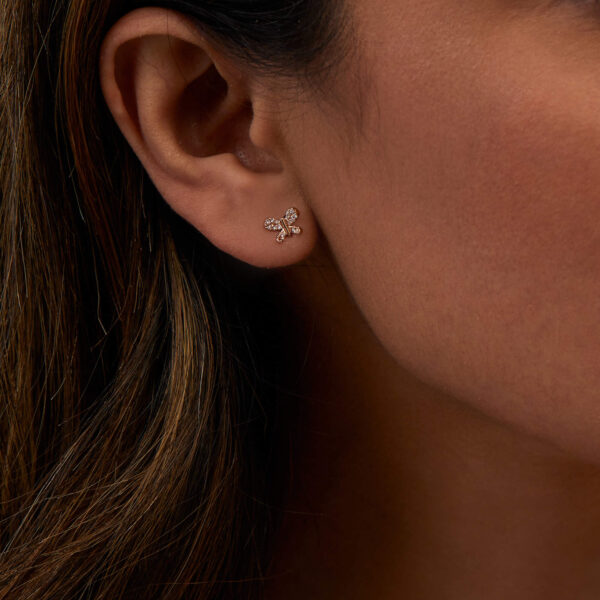 FE174-2-1.jpg | foroworld | foroworld